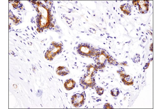 Immunohistochemistry Image 2: INPP4b (D9K1B) XP<sup>®</sup> Rabbit mAb