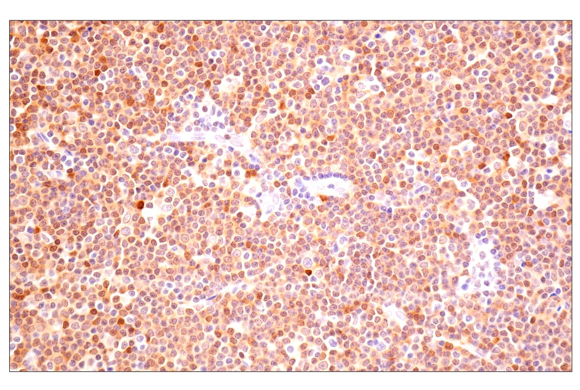 Immunohistochemistry Image 3: ACBP/DBI (E6K8G) XP<sup>®</sup> Rabbit mAb