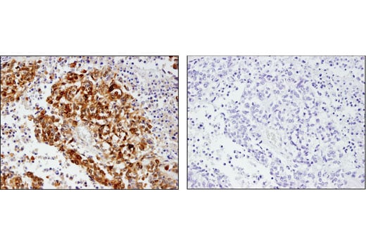 Immunohistochemistry Image 3: Phospho-YAP (Ser127) (D9W2I) Rabbit mAb