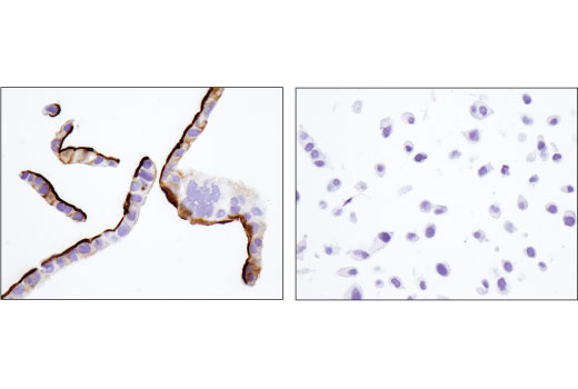 Immunohistochemistry Image 5: CD133 (D4W4N) XP<sup>®</sup> Rabbit mAb (BSA and Azide Free)