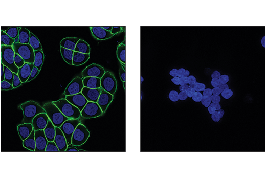 Immunofluorescence Image 1: Catenin δ-1 (D7S2M) XP<sup>®</sup> Rabbit mAb