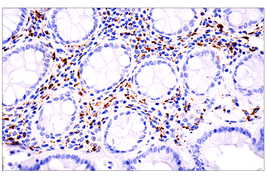 Immunohistochemistry Image 2: Calretinin (E7R6O) XP<sup>®</sup> Rabbit mAb