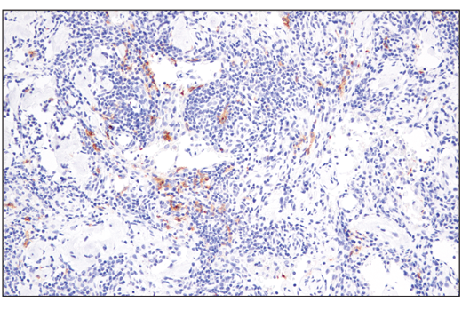 Immunohistochemistry Image 4: XCR1 (D2F8T) Rabbit mAb