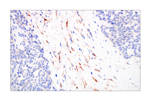 Immunohistochemistry Image 4: CYR61 (E5W3H) Rabbit mAb