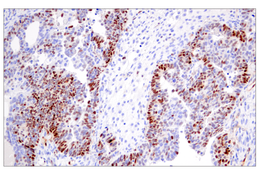 Immunohistochemistry Image 3: Cyclin D1 (E3P5S) XP<sup>®</sup> Rabbit mAb (BSA and Azide Free)