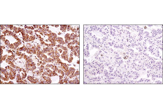 Immunohistochemistry Image 3: ATPIF1 (D6P1Q) XP<sup>®</sup> Rabbit mAb