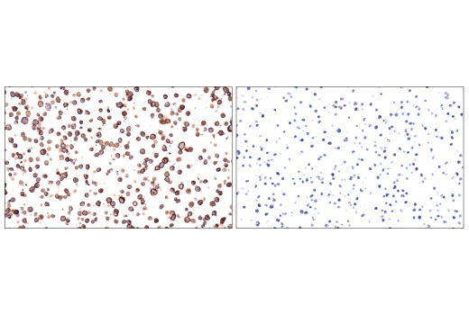 Immunohistochemistry Image 7: CD20 (E7B7T) XP<sup>®</sup> Rabbit mAb (BSA and Azide Free)
