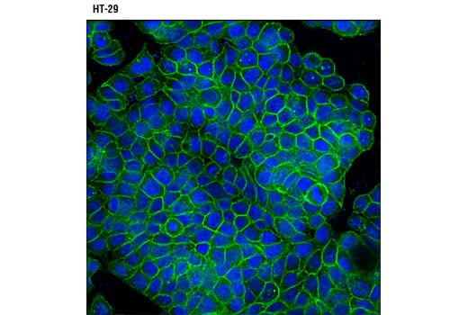 undefined Image 38: Glutamine Metabolism Antibody Sampler Kit