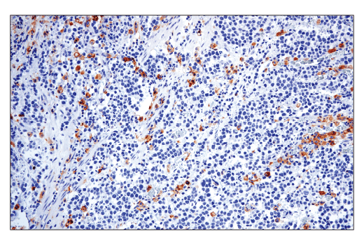 Immunohistochemistry Image 2: CD86 (E2G8P) Rabbit mAb (BSA and Azide Free)