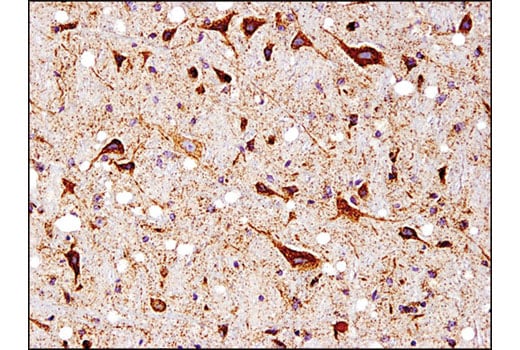 Immunohistochemistry Image 1: SOD2 (D3X8F) XP<sup>®</sup> Rabbit mAb
