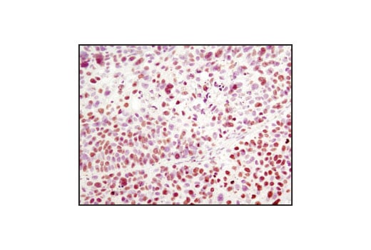 Immunohistochemistry Image 1: Histone H2A (L88A6) Mouse mAb (BSA and Azide Free)