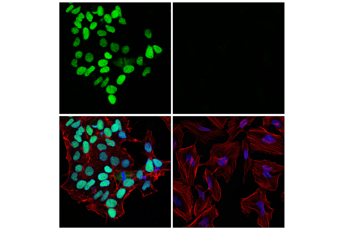 Immunofluorescence Image 1: Sox2 (E4I2X) Rabbit mAb