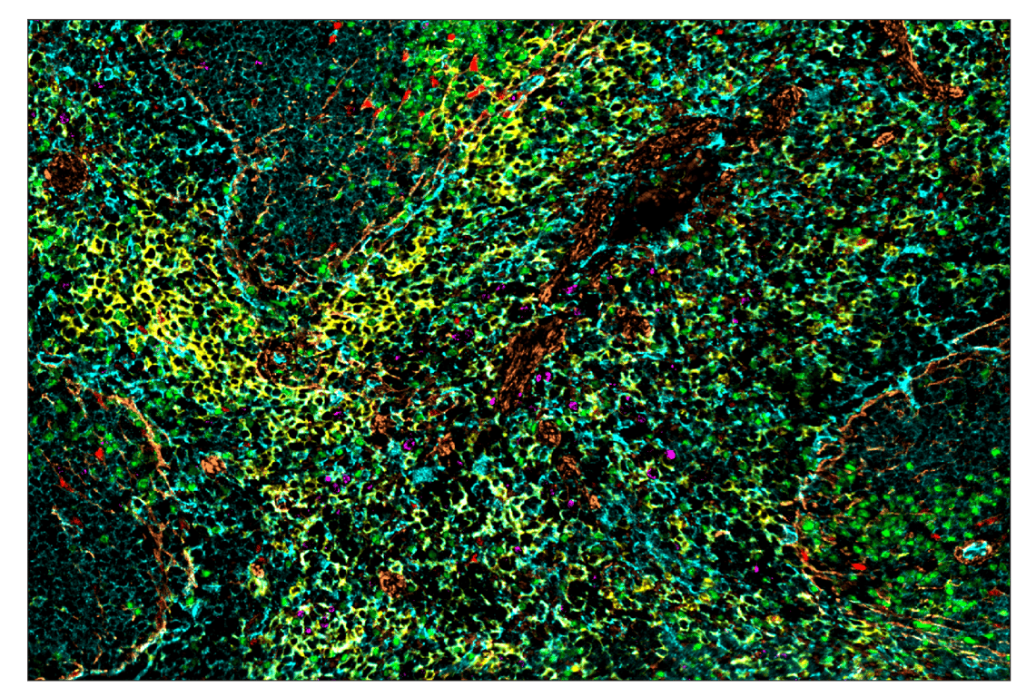 Immunohistochemistry Image 1: Ki-67 (D3B5) & CO-0052-488 SignalStar<sup>™</sup> Oligo-Antibody Pair