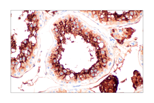 Immunohistochemistry Image 3: ACE2 (OTI1G4) Mouse mAb