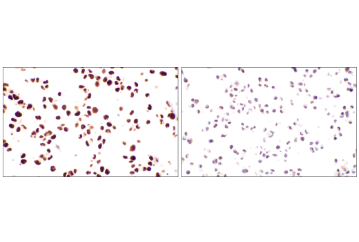 Immunohistochemistry Image 2: DNMT1 (D63A6) XP<sup>®</sup> Rabbit mAb (BSA and Azide Free)