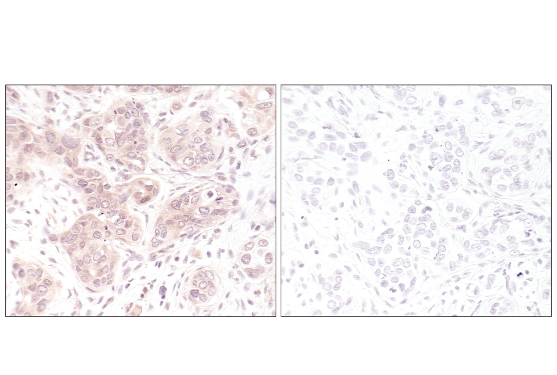 Immunohistochemistry Image 1: p44/42 MAPK (Erk1/2) (L34F12) Mouse mAb