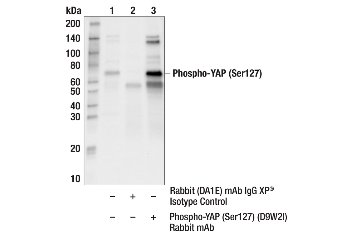 Immunoprecipitation Image 1: Phospho-YAP (Ser127) (D9W2I) Rabbit mAb