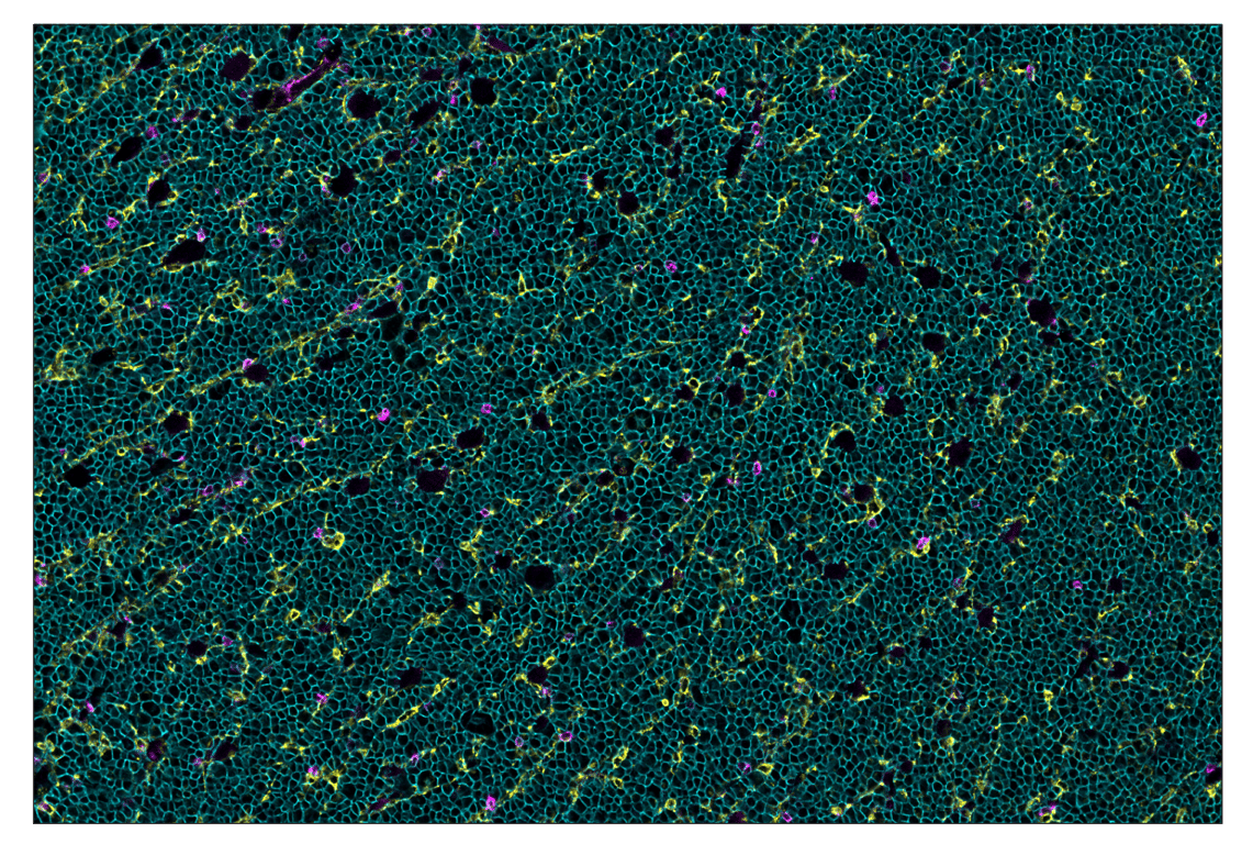 Immunohistochemistry Image 1: CD20 (E3N7O) & CO-0134-750 SignalStar<sup>™</sup> Oligo-Antibody Pair