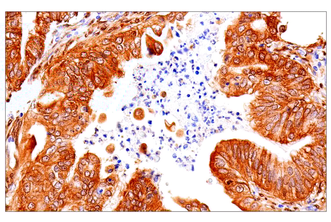 Immunohistochemistry Image 4: Phospho-YAP (Ser61) (E4Q8S) Rabbit mAb