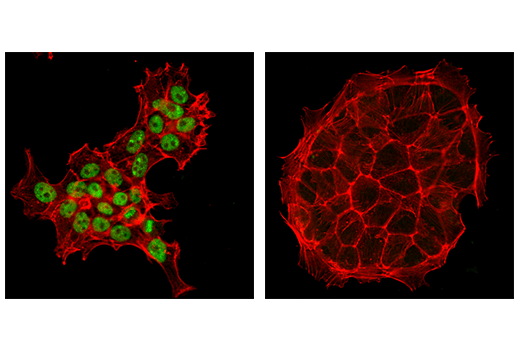 Immunofluorescence Image 1: p300 (D8Z4E) Rabbit mAb