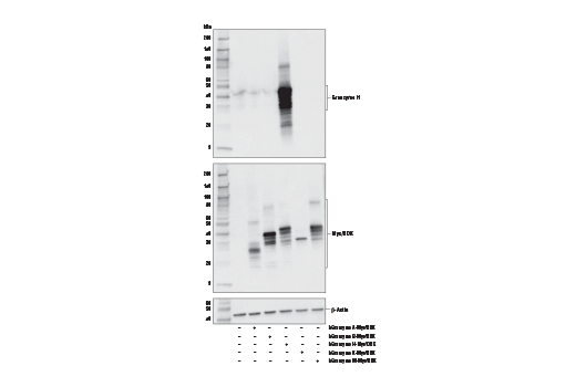 Western Blotting Image 2: Granzyme H (E4T2E) Rabbit mAb