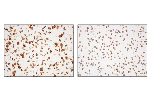 Immunohistochemistry Image 1: α-Actinin 4 (D7U5A) Rabbit mAb 