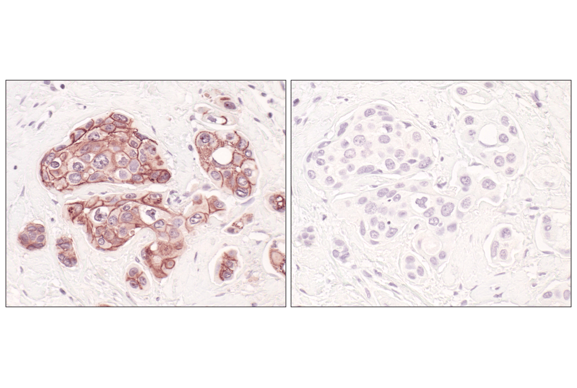 undefined Image 46: Cadherin-Catenin Antibody Sampler Kit
