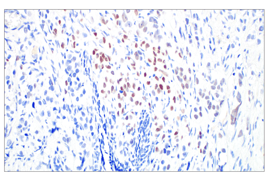 Immunohistochemistry Image 2: Phospho-Histone H2A.X (Ser139) (20E3) Rabbit mAb