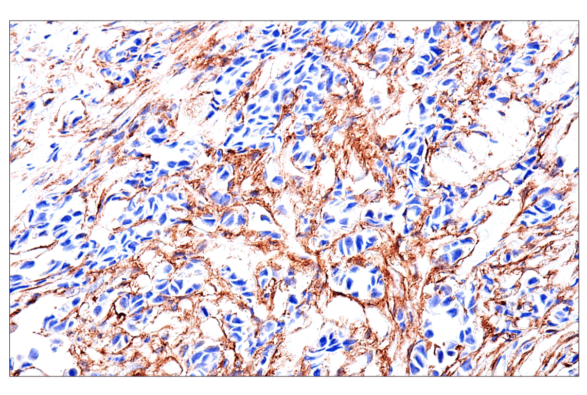 Immunohistochemistry Image 1: FAP (F1A4G) Rabbit mAb (BSA and Azide Free)