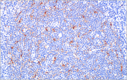 Immunohistochemical analysis of paraffin-embedded spleen using FoxP3 (D6O8R) Rabbit mAb