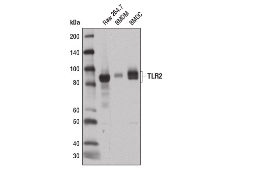 Western Blotting Image 1: Toll-like Receptor 2 (E1J2W) Rabbit mAb