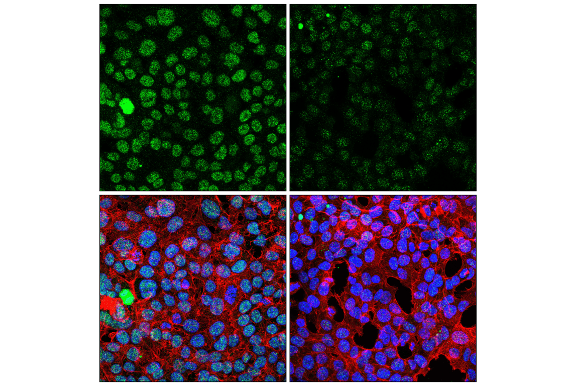 Immunofluorescence Image 1: BRD4 Isoform C (E1Q9N) Rabbit mAb