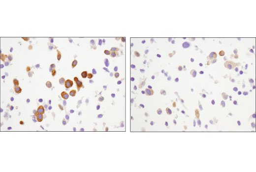 Immunohistochemistry Image 4: Phospho-CAD (Ser1859) (D5K5W) Rabbit mAb