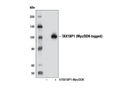 undefined Image 19: Xenophagy Antibody Sampler Kit