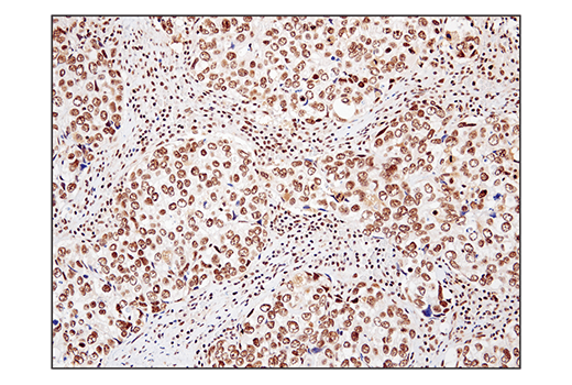 undefined Image 34: BAF Complex IHC Antibody Sampler Kit