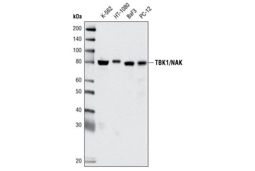 Western Blotting Image 2: TBK1/NAK (D1B4) Rabbit mAb