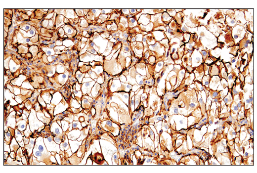 Immunohistochemistry Image 1: CD54/ICAM-1 (E3Q9N) XP<sup>®</sup> Rabbit mAb (BSA and Azide Free)