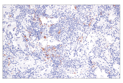 Immunohistochemistry Image 1: XCR1 (D2F8T) Rabbit mAb (BSA and Azide Free)