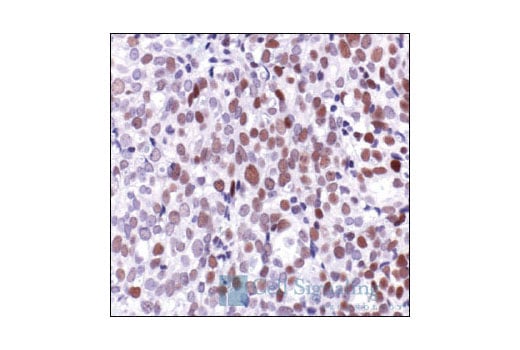 undefined Image 13: PhosphoPlus<sup>®</sup> c-Jun (Ser73) Antibody Duet