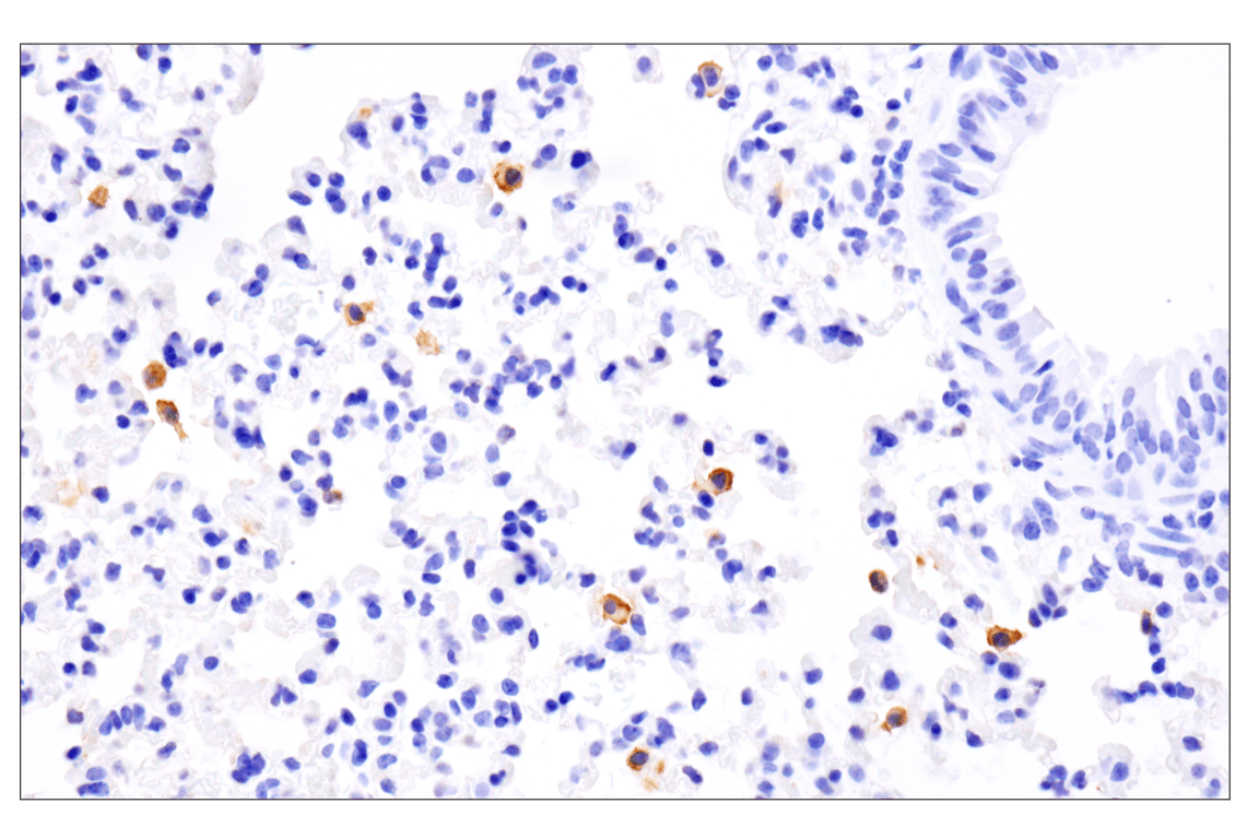 Immunohistochemistry Image 4: PD-L1 (F3Z1T) Rabbit mAb (IHC Formulated)