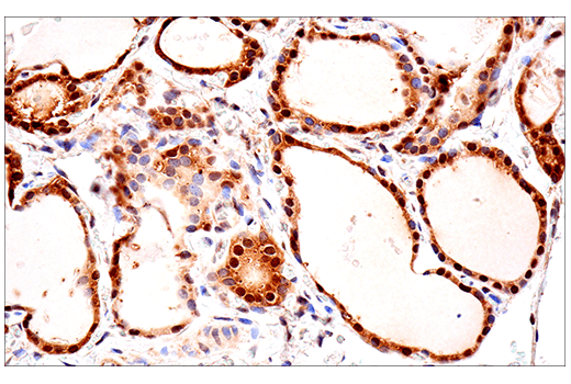 Immunohistochemistry Image 10: SOD1 (E4G1H) XP<sup>®</sup> Rabbit mAb