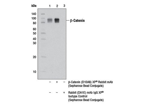 Immunoprecipitation Image 1: β-Catenin (D10A8) XP<sup>®</sup> Rabbit mAb (Sepharose<sup>®</sup> Bead Conjugate)