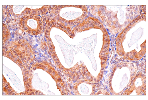 Immunohistochemistry Image 2: p70 S6 Kinase (E8K6T) XP<sup>®</sup> Rabbit mAb