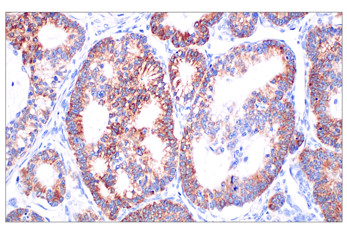 Immunohistochemistry Image 1: CPT1A (E3Y1V) Rabbit mAb
