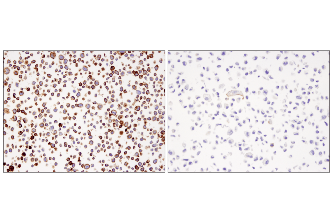 Immunohistochemistry Image 1: PD-L1 (405.9A11) Mouse mAb (BSA and Azide Free)