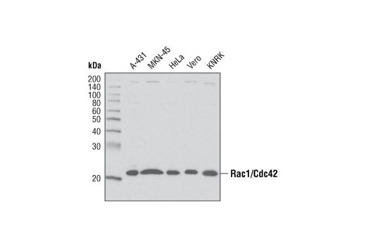 undefined Image 5: Actin Nucleation and Polymerization Antibody Sampler Kit