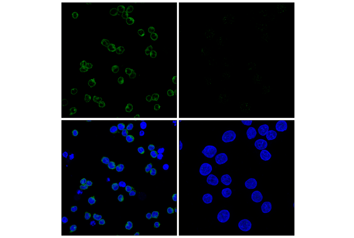 Immunofluorescence Image 1: Gab1 (E8U1S) Rabbit mAb