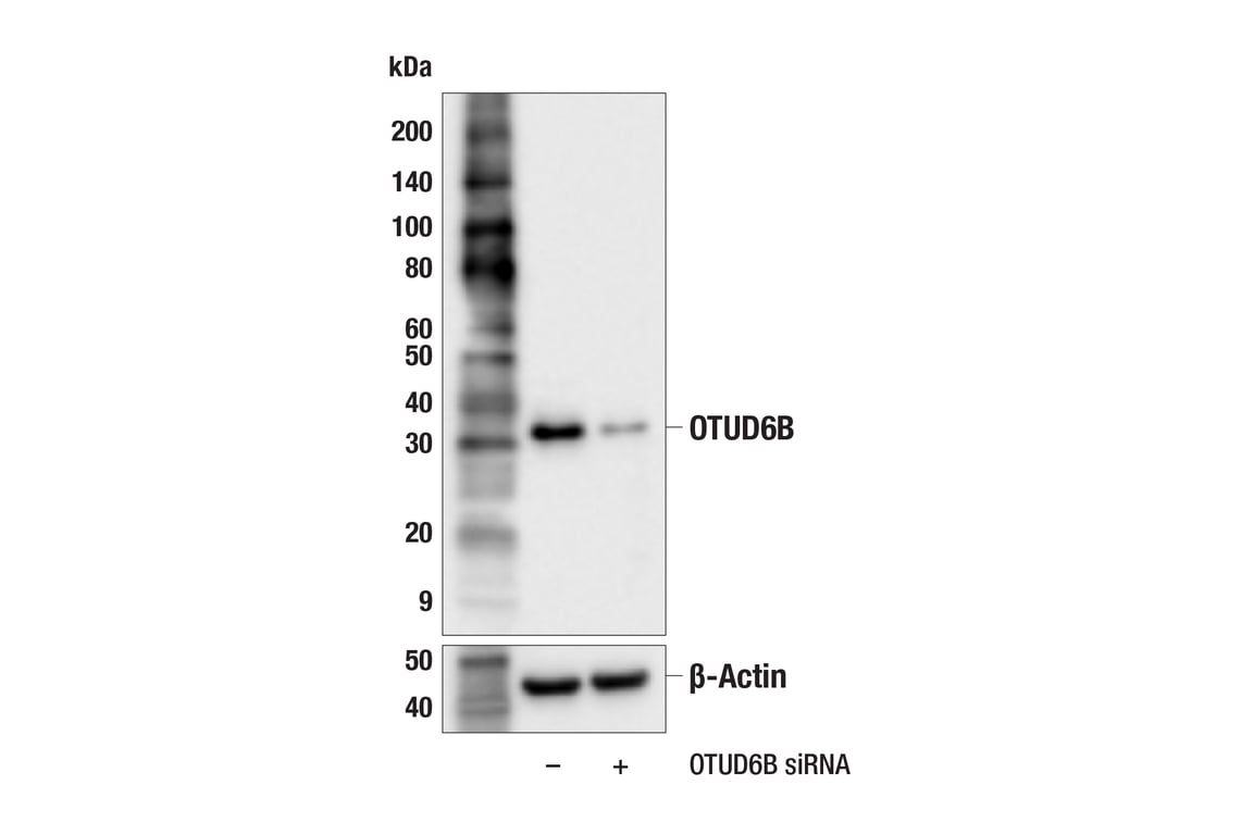 Western Blotting Image 1: OTUD6B (F6K7V) Rabbit mAb