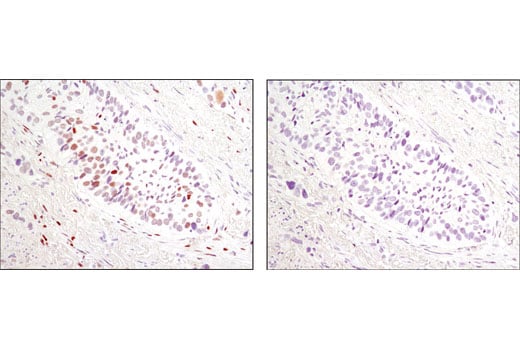 undefined Image 7: PhosphoPlus<sup>®</sup> c-Jun (Ser73) Antibody Duet