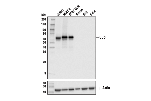 Western Blotting Image 1: CD5 (E8X3S) XP<sup>®</sup> Rabbit mAb (BSA and Azide Free)